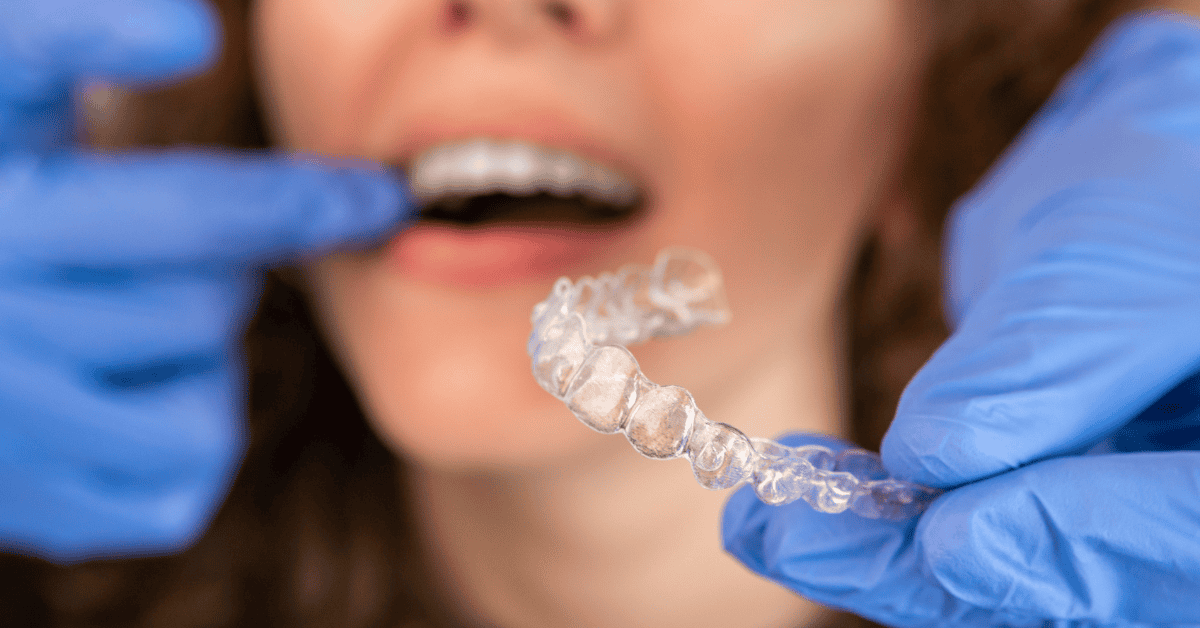 Why Invisalign Is the Perfect Resolution for a Healthier Smile